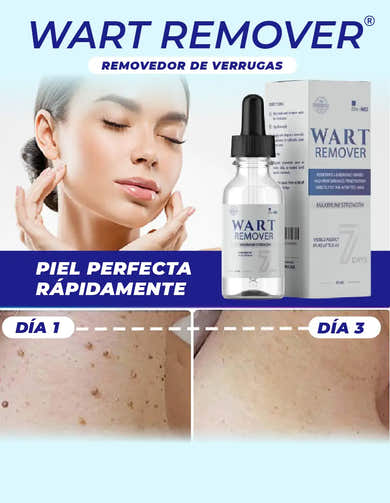 Imagen del carrusel