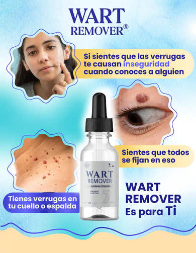 Imagen del carrusel