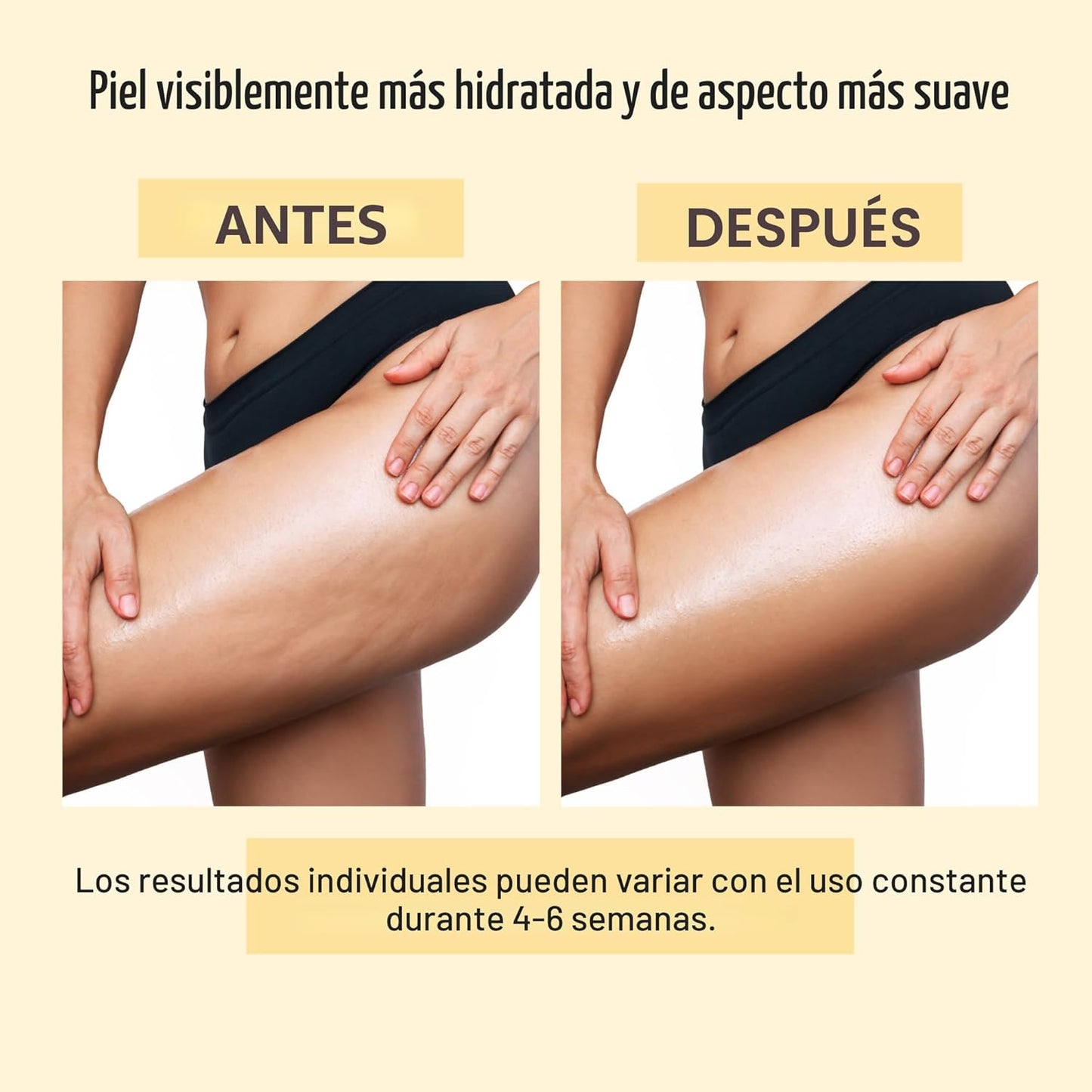ACEITE ANTI CELULLITIS [PV1-WHATSAPP-MAXTRENDSHOPS]