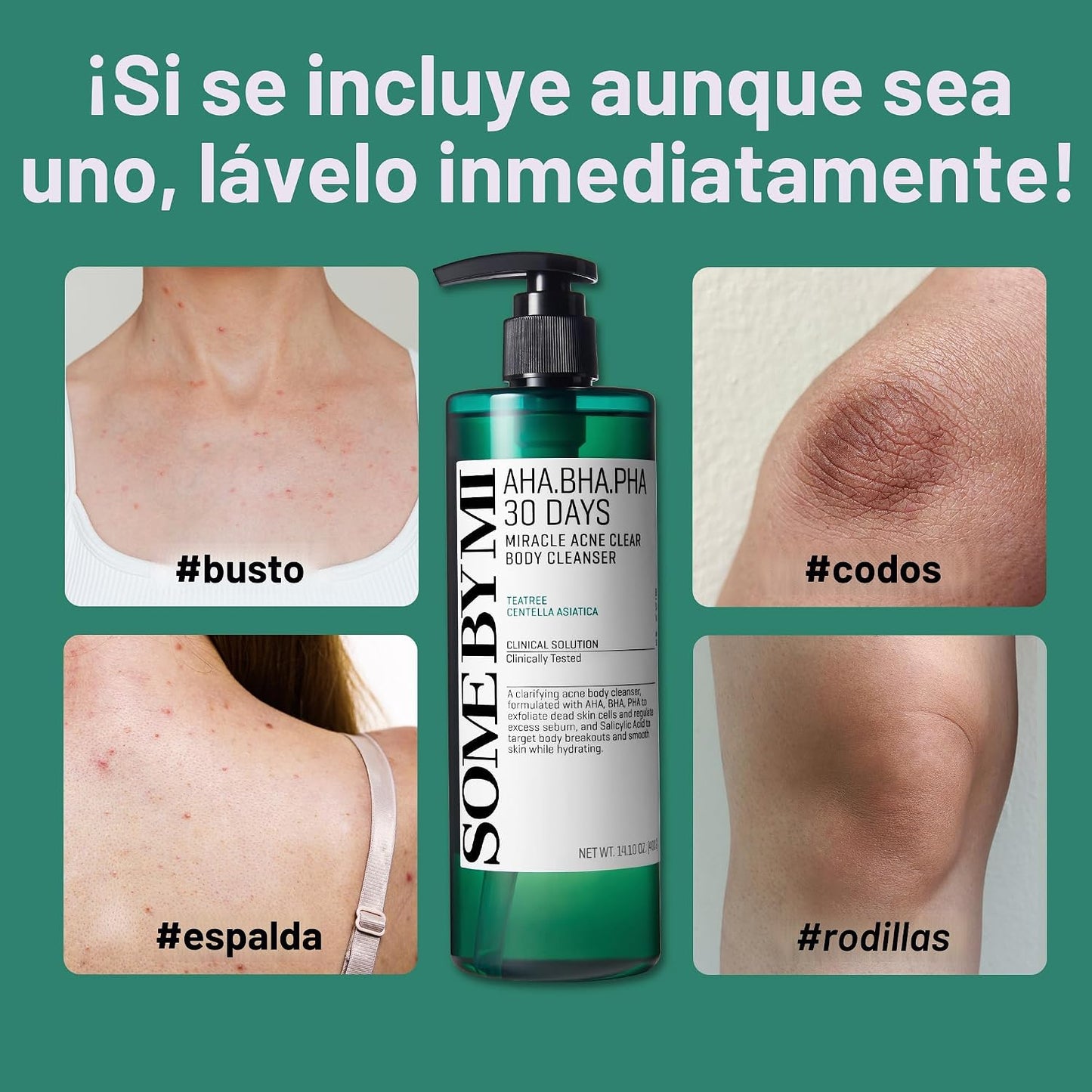 GEL DE BAÑO ANTI ACNE [PV1-WHATSAPP-MAXTRENDSHOPS]