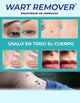 Miniatura de imagen