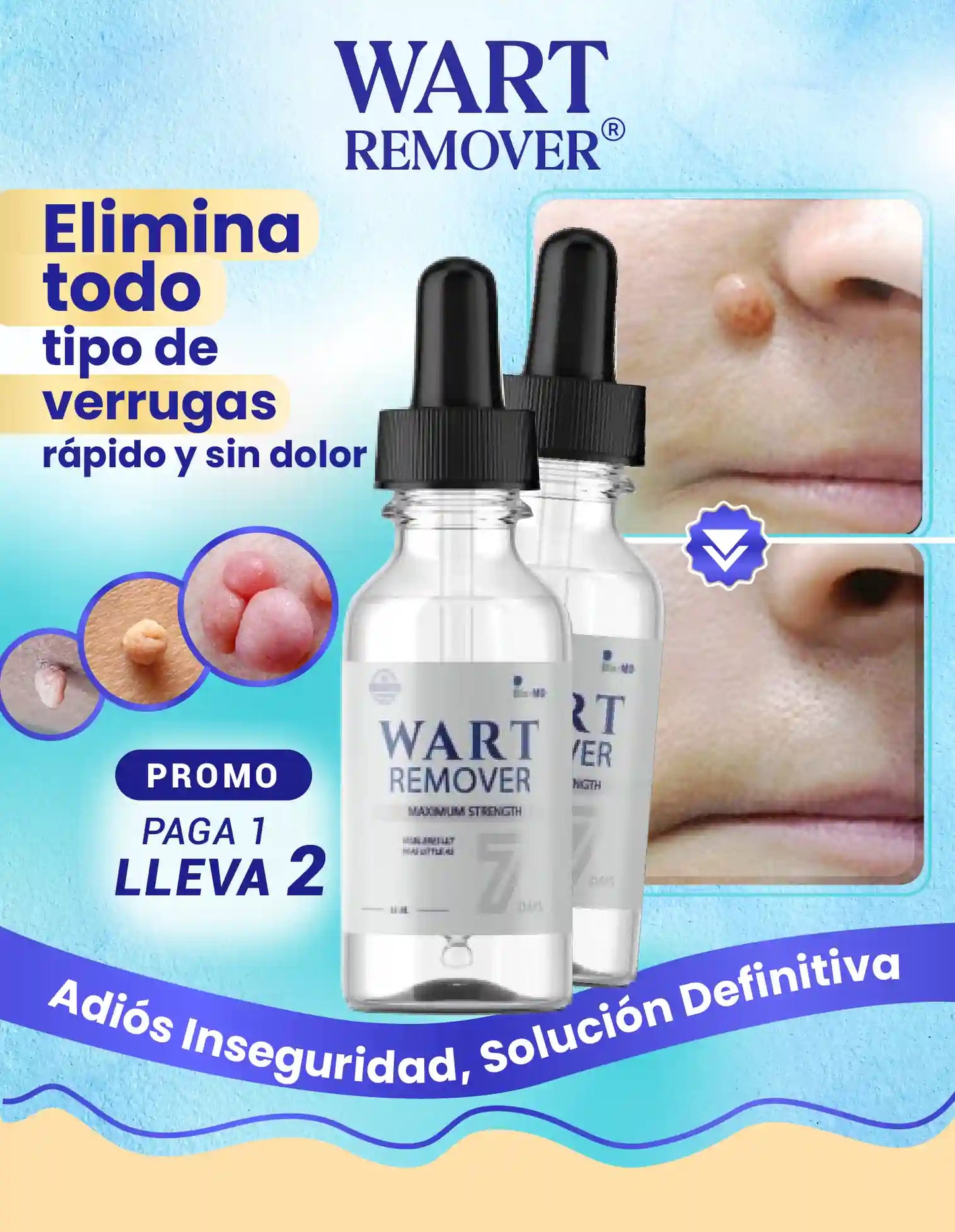 REMOVEDOR DE VERRUGAS WART REMOVER [PV2-META-MAXTRENDSHOPS]