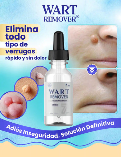 Imagen del carrusel