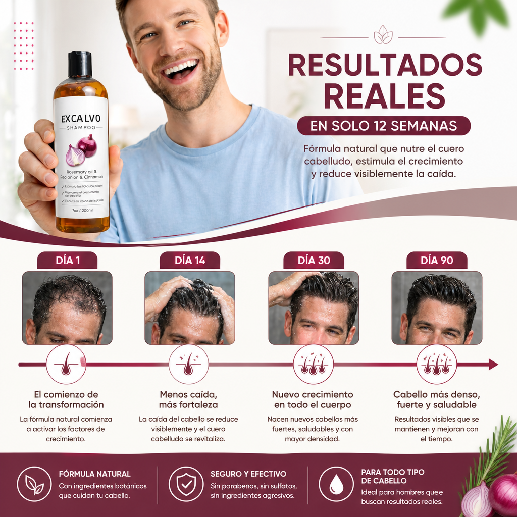 SHAMPOO EX CALVO [PV1-WHATSAPP-MAXTRENDSHOPS]