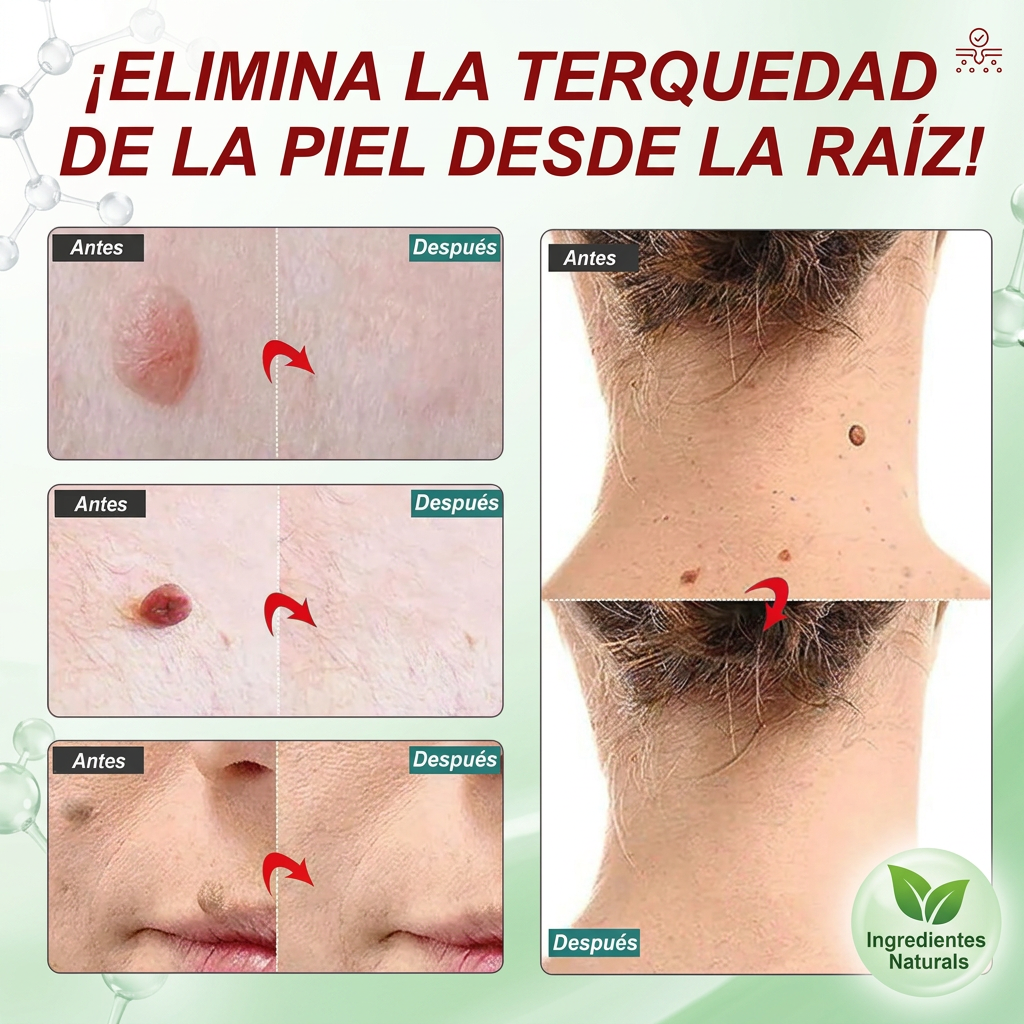 CREMA PARA ELIMINAR VERRUGAS [PV1-WHATSAPP-MAXTRENDSHOPS]